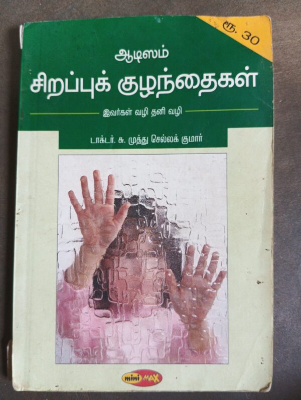 சிறப்பு குழந்தைகள்